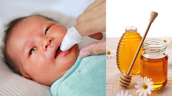 đánh tưa lưỡi cho trẻ dưới 1 tuổi bằng mật ong