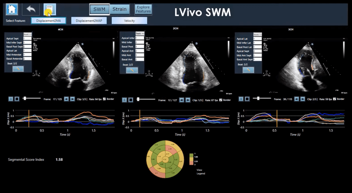 healthcare ux. DiA Imaging Analysis
