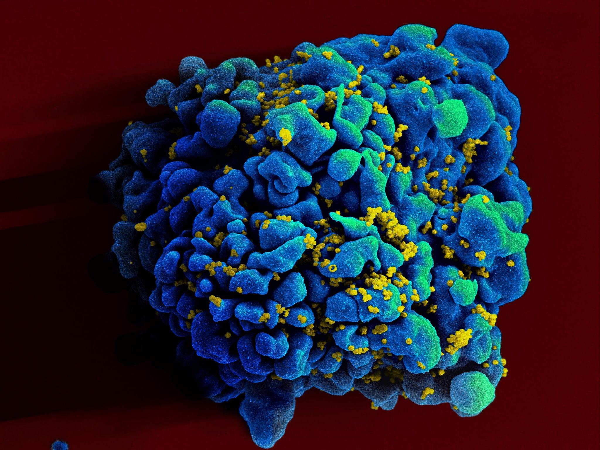 HIV affected cell