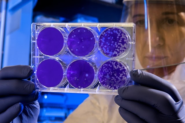 Análises ‘in vitro’ mostram que moléculas fotossensibilizadoras ligadas a imunoglobulinas são capazes de destruir as células infectadas pelo HIV e o vírus livre circulante. Foto: Reprodução/Unplash