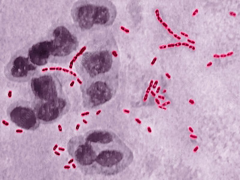 Microscopia da Haemophillus dureyi. Perceba a configuração em “cardume de peixe”. Fonte: Ibap Cursos (https://ibapcursos.com.br/tudo-sobre-cancro-mole-cancroide-o-que-e-sintomas-diagnostico-e-tratamento/haemophilus-ducreyi/)