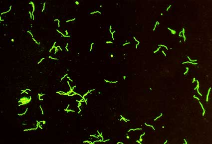 Microscopia à campo escuro evidenciando a Treponema Pallidum. Fonte: Biomedicina Total (https://www.biomedicinatotal.com.br/2018/11/diagnostico-sifilis-ms.html)