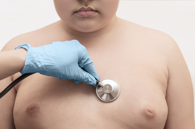 Ao conter o ganho de peso nos primeiros anos de vida, os probióticos podem ser capazes de prevenir a obesidade infantil. Foto: Reprodução/Adobe Stock