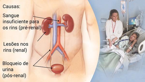 Fonte: Marconato Urologia (http://www.clinicamarconato.com.br/tratamentos/insuficiencia-renal-aguda/)
