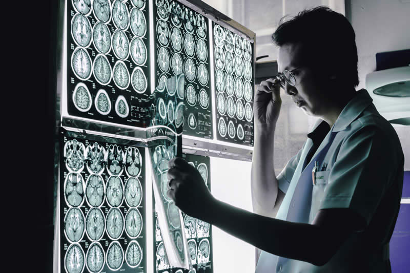 Quais as áreas de atuação para um neurologista?