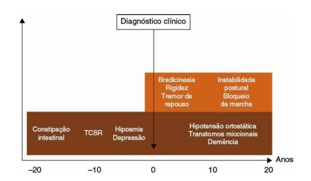Principais manifestações motoras (em laranja) e não motoras (em marrom) da doença de Parkinson ao longo dos anos. TCSR: transtorno comportamental do sono REM
