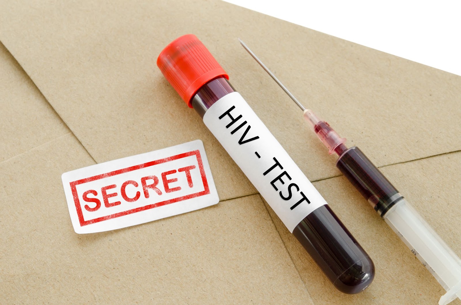 O HIV 1 é confirmado por testes sorológicos, enquanto o diagnóstico do HIV 2 se dá por testes específicos. Foto: Reprodução/AdobeStock