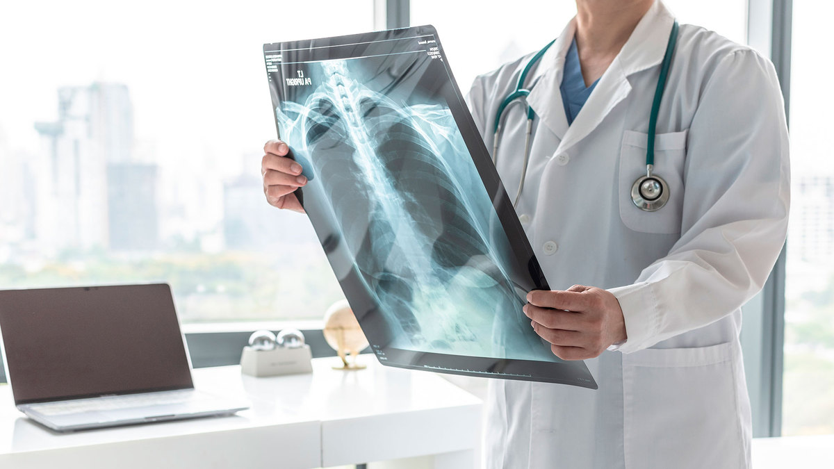 Derrame pleural o que é, sintomas e formas de tratamento