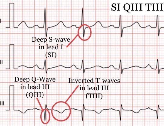 Ауди q3 2018. Ауди q3 2016. Q1 s3. Audi кроссовер q3. Audi q3 201.