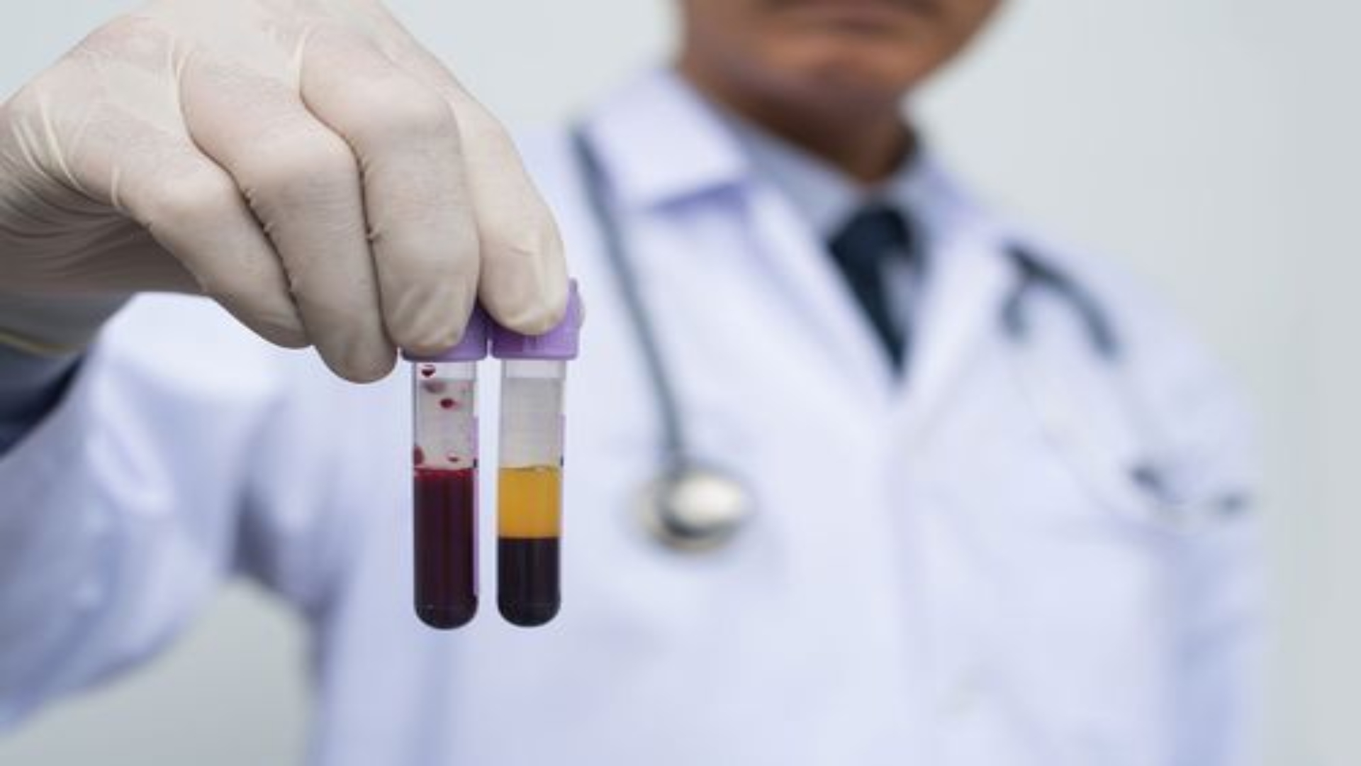 Hematologia e Hemoterapia: residência médica, áreas de atuação e rotina