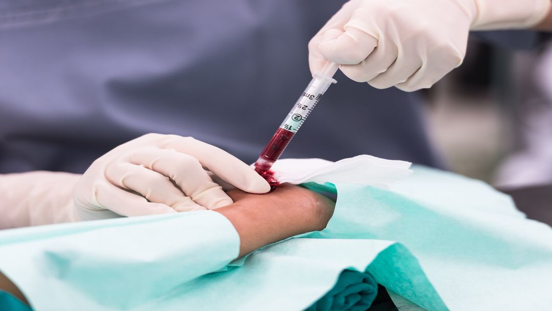 Entenda Sobre A Interpretação De Gasometria – DZVZCH