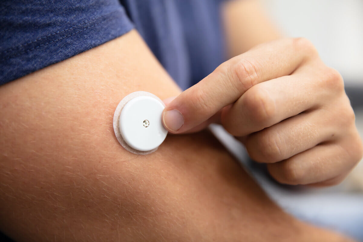 Fasting blood sugar levels: A closeup of a CGM sensor on a man's arm