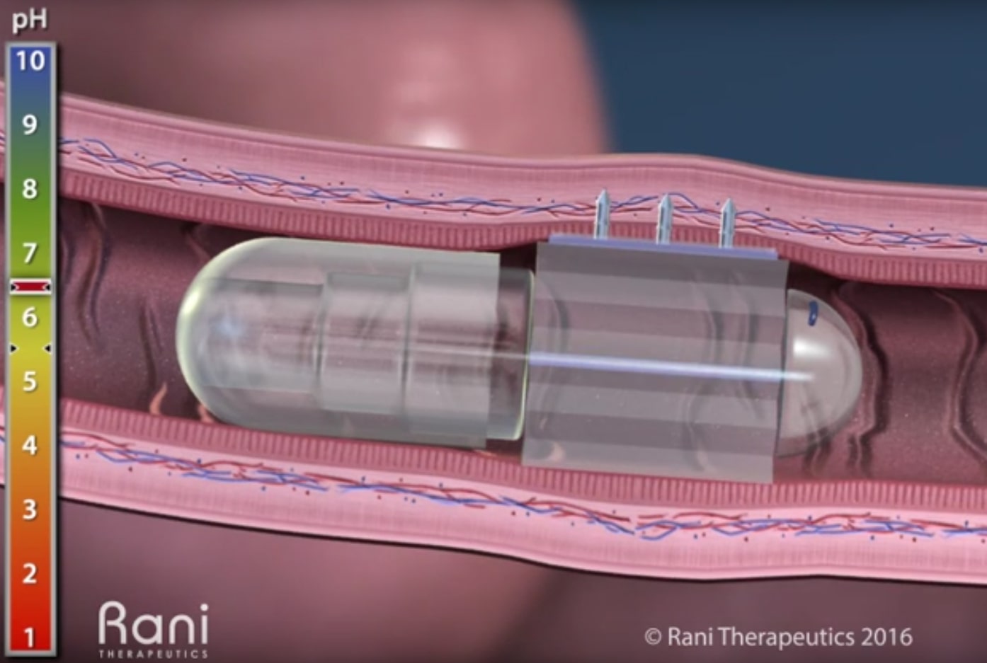 Rani Therapeutics