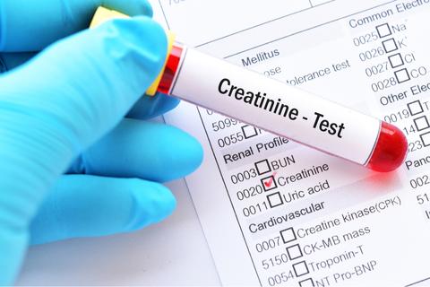 creatine coaching proteine whey achzod prise de masse programme musculation seche musculation