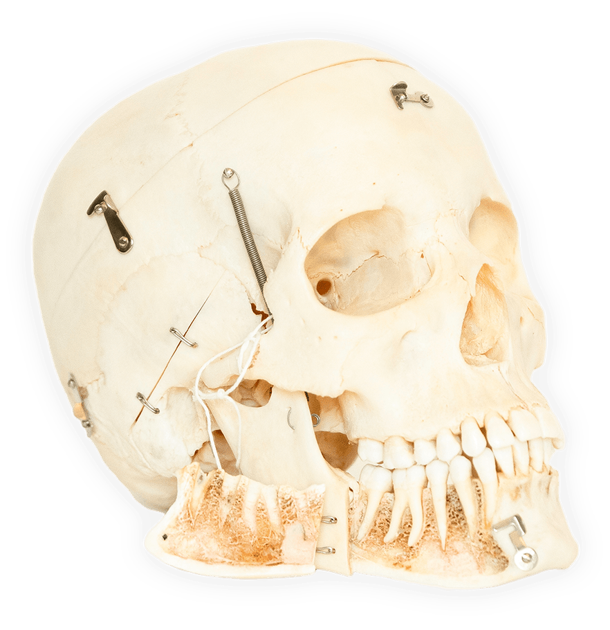 A perfect medical skull