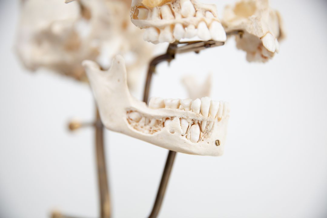 Adolescent exploded skull | JonsBones: Responsibly Sourced Human Osteology