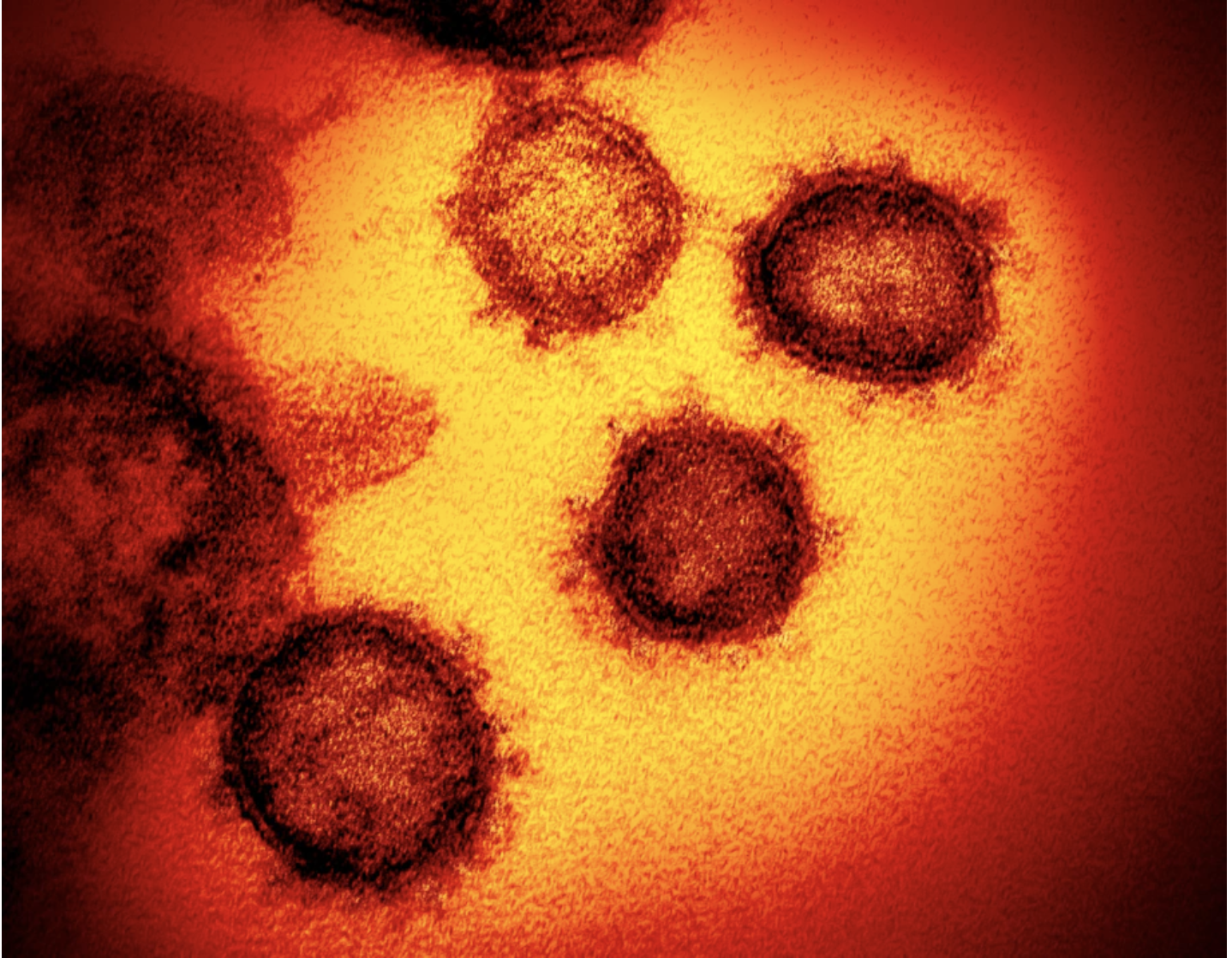 Inconclusive review of virus origins prompts calls for more probes: ‘We have to get to the bottom of this’