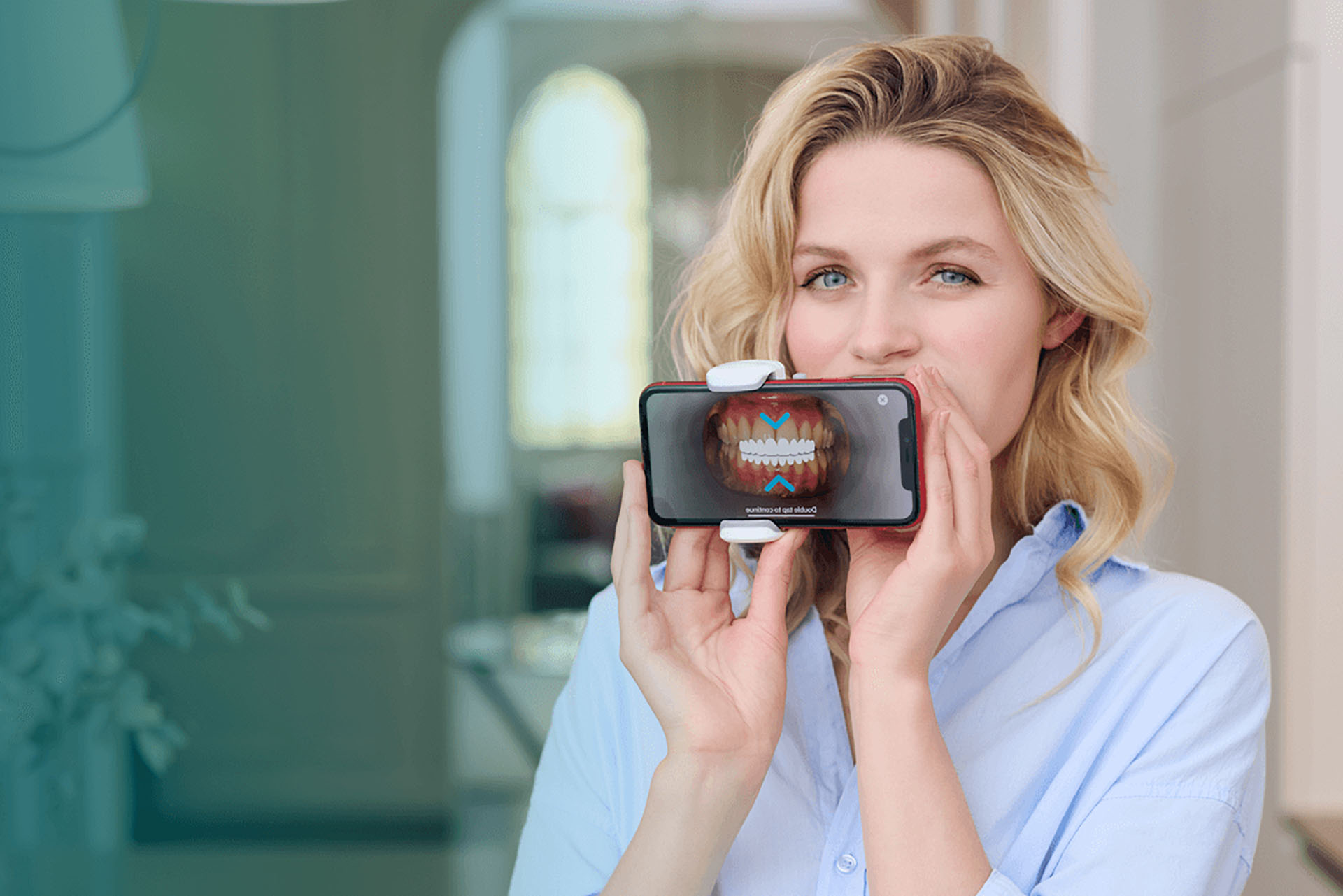 Remote Dental Monitoring