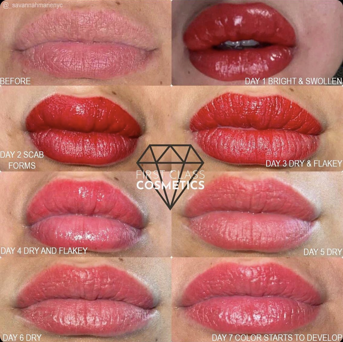 Lip Blush Procedure Progress