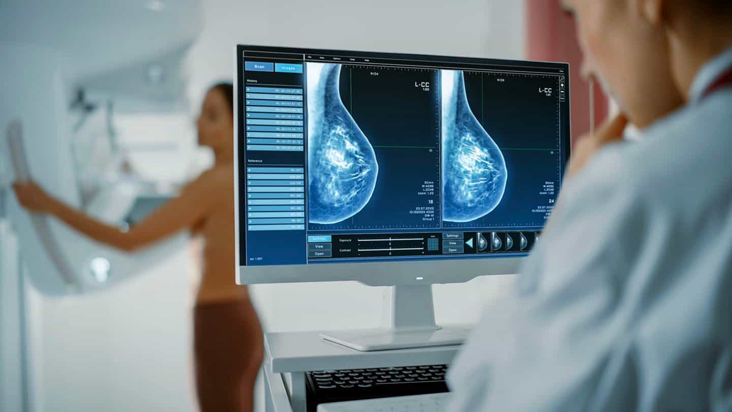 doctor looking at a scan of a mammogram