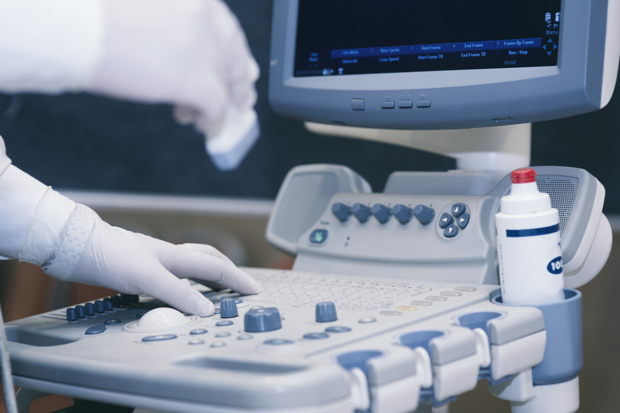 Hysterosonogram (HSN) or Sonohsterogram (SHG)
