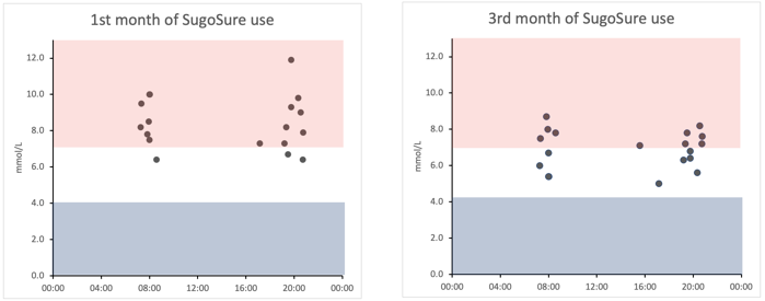Blood glucose reading patterns in the 1st and 3rd months of SugoSure use for Beta Test Patient LT
