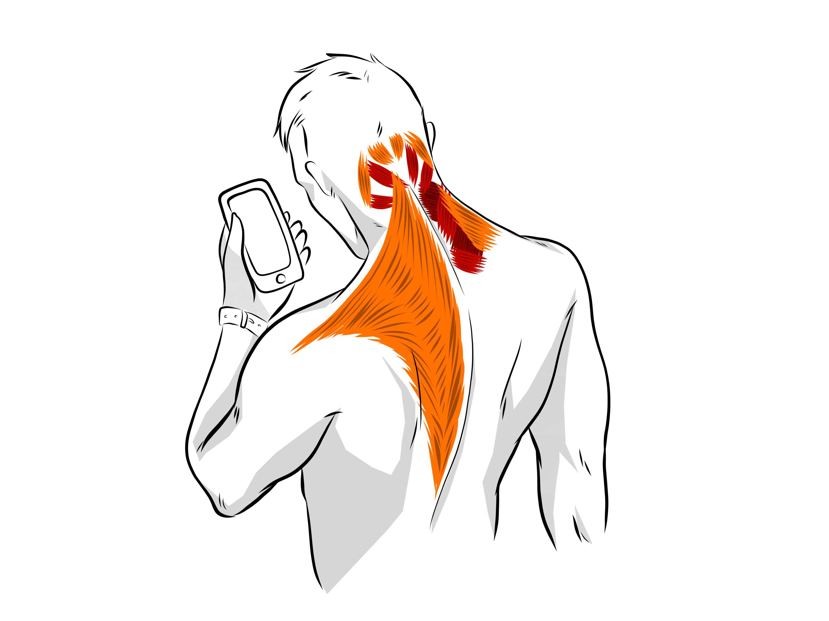 How to Get a Trapezius Knot Release