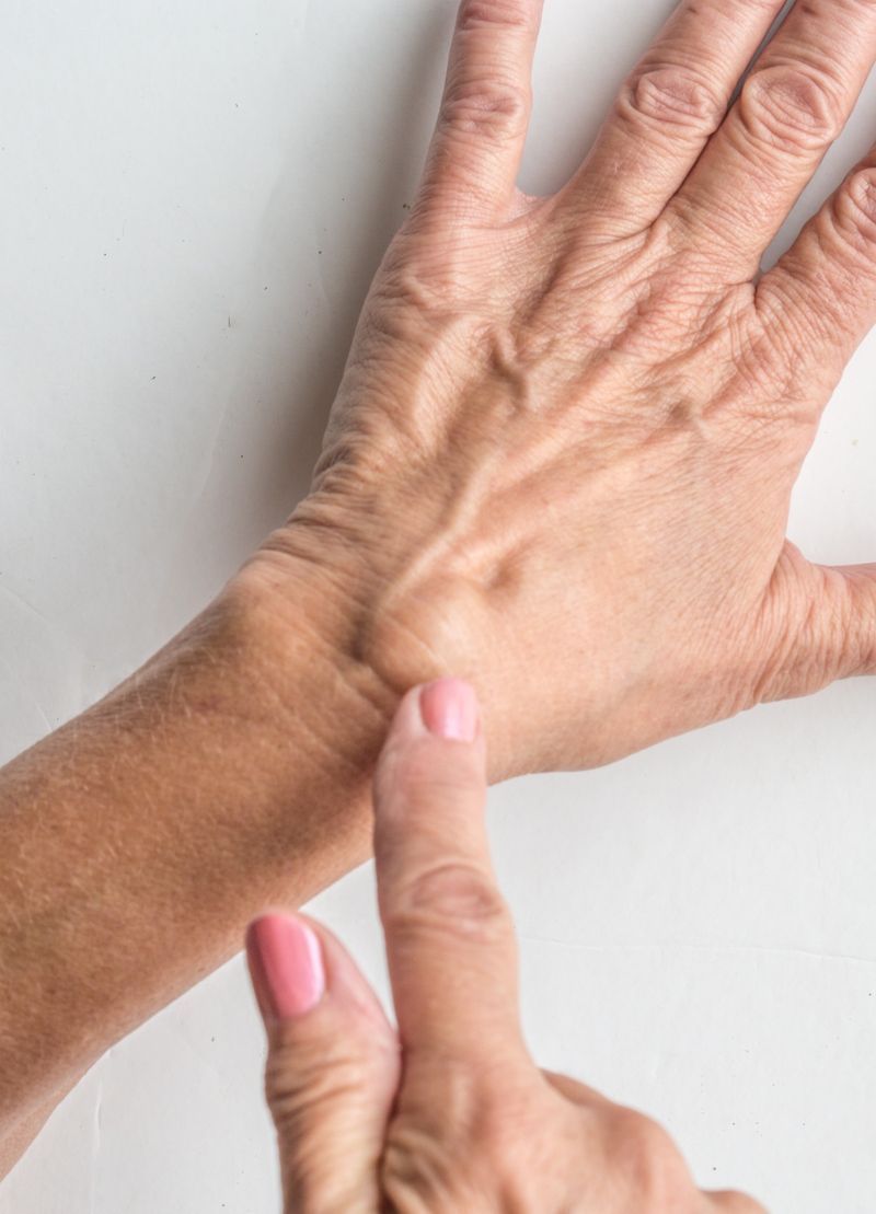 Ganglion Cyst Orthopedic Centers of Colorado