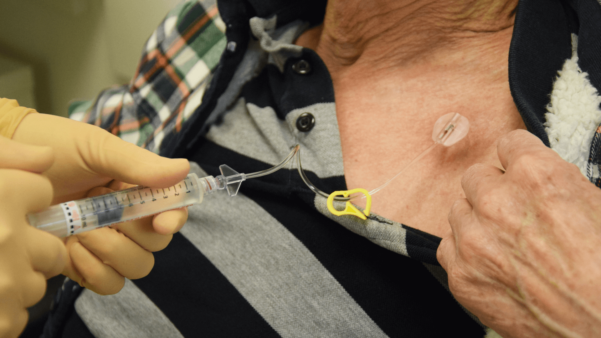 Bard Port Catheter Lawsuits | Edgar Snyder & Associates